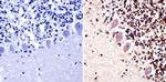 PARP1 Antibody in Immunohistochemistry (Paraffin) (IHC (P))