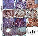 VCP Antibody in Immunohistochemistry (IHC)