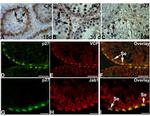 VCP Antibody in Immunohistochemistry (IHC)