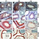 VCP Antibody in Immunohistochemistry (IHC)