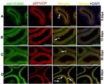 VCP Antibody in Immunohistochemistry (IHC)