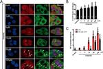 VCP Antibody in Immunocytochemistry (ICC/IF)