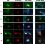 PDI Antibody in Immunocytochemistry (ICC/IF)