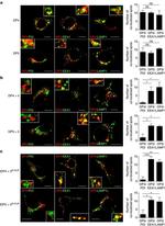 PDI Antibody in Immunocytochemistry (ICC/IF)