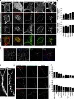 mtHSP70 Antibody in Immunohistochemistry (IHC)