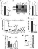 Acetylcholinesterase Antibody in Western Blot (WB)