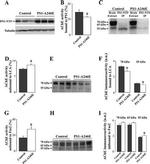 Acetylcholinesterase Antibody in Western Blot (WB)