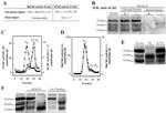 Acetylcholinesterase Antibody in Western Blot, Immunoprecipitation (WB, IP)