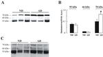 Acetylcholinesterase Antibody in Western Blot (WB)