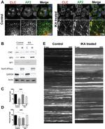 alpha Adaptin Antibody in Western Blot (WB)