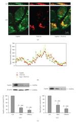 TGN46 Antibody in Immunocytochemistry (ICC/IF)