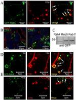 RAB9 Antibody in Immunocytochemistry (ICC/IF)