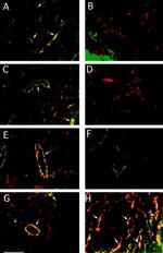 CD31 Antibody in Immunohistochemistry (IHC)