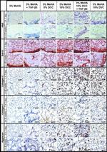 Aggrecan Antibody in Immunohistochemistry (Frozen) (IHC (F))