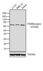 TSH Receptor Antibody in Western Blot (WB)