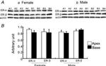 Estrogen Receptor alpha Antibody in Western Blot (WB)