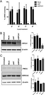 SERCA2 ATPase Antibody in Western Blot (WB)