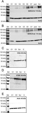 SERCA1 ATPase Antibody in Western Blot (WB)