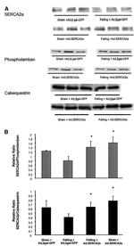 SERCA2 ATPase Antibody in Western Blot (WB)