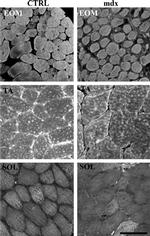 Calsequestrin Antibody in Immunocytochemistry (ICC/IF)