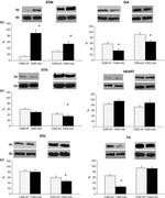 Calsequestrin Antibody in Western Blot (WB)