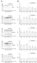 PMCA ATPase Antibody in Western Blot (WB)