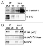 ATP1A3 Antibody in Western Blot (WB)