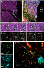 Calsequestrin Antibody in Immunohistochemistry (IHC)