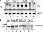 SERCA2 ATPase Antibody in Western Blot (WB)