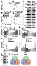 SERCA2 ATPase Antibody in Western Blot (WB)