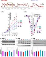 Phospholamban Antibody in Western Blot (WB)