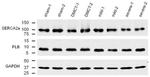 SERCA2 ATPase Antibody in Western Blot (WB)