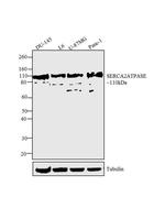 SERCA2 ATPase Antibody in Western Blot (WB)