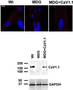 CaV1.1 Antibody in Western Blot (WB)