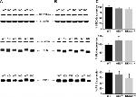 Phospholamban Antibody in Western Blot (WB)