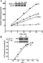 Phospholamban Antibody in Western Blot (WB)