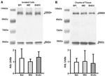 Sodium/Calcium Exchanger Antibody in Western Blot (WB)