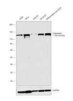 Calpastatin Antibody in Western Blot (WB)