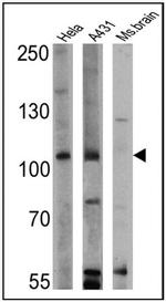 RASA1 Antibody in Western Blot (WB)