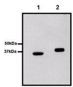 GST Tag Antibody in Immunoprecipitation (IP)