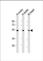 VEGFC Antibody in Western Blot (WB)