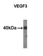 VEGFC Antibody in Western Blot (WB)
