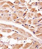 PINK1 Antibody in Immunohistochemistry (Paraffin) (IHC (P))