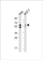 PINK1 Antibody in Western Blot (WB)