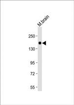 LRRK2 Antibody in Western Blot (WB)