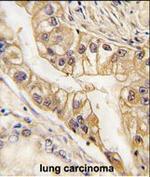 EphB2 Antibody in Immunohistochemistry (Paraffin) (IHC (P))