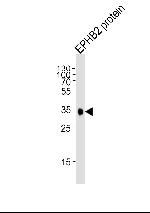 EphB2 Antibody in Western Blot (WB)