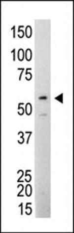 SRC Antibody in Western Blot (WB)