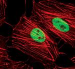 H3K4me3 Antibody in Immunocytochemistry (ICC/IF)