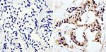 MUC1 Antibody in Immunohistochemistry (Paraffin) (IHC (P))